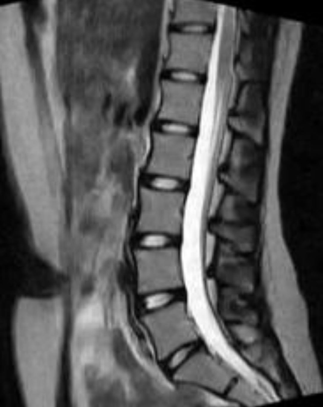 ヘルニア Drive Belt For Exmark 1-323299 | 8TEN